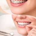 Invisalign en Molina de Segura